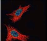 FMRP Antibody in Immunocytochemistry (ICC/IF)