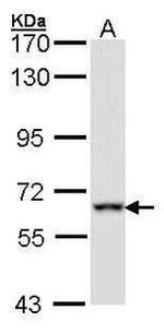 FMRP Antibody in Western Blot (WB)