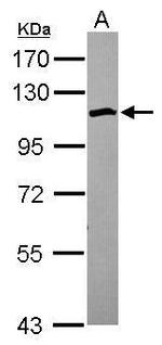 SCP1 Polyclonal Antibody