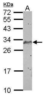 SCP3 Polyclonal Antibody