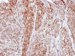 Ferritin Light Chain Polyclonal Antibody