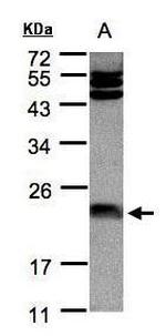 Ferritin Light Chain Antibody in Western Blot (WB)