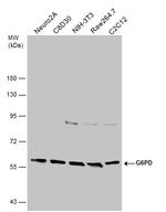 G6PD Antibody in Western Blot (WB)