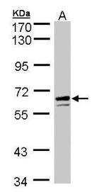 G6PD Antibody in Western Blot (WB)