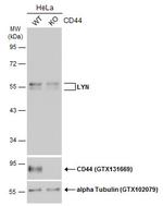 Lyn Antibody in Western Blot (WB)