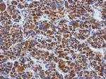 DLD Polyclonal Antibody