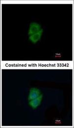 Decorin Polyclonal Antibody