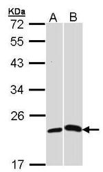 CRP Antibody in Western Blot (WB)