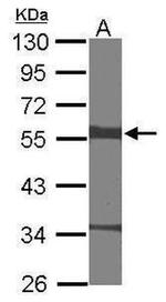 ELK1 Antibody in Western Blot (WB)