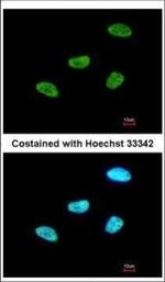 MEF2A Antibody in Immunocytochemistry (ICC/IF)