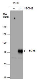 Butyrylcholinesterase Antibody in Western Blot (WB)