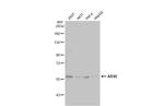 Arylsulfatase E Polyclonal Antibody