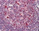 BCL6 Antibody in Immunohistochemistry (Paraffin) (IHC (P))