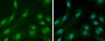 Ataxin 3 Polyclonal Antibody