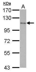 c-Cbl Antibody in Western Blot (WB)