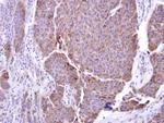 ADAM17 Polyclonal Antibody