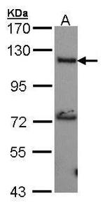ADCY2 Antibody in Western Blot (WB)