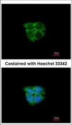Adenosine Kinase Antibody in Immunocytochemistry (ICC/IF)