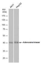 Adenosine Kinase Antibody in Western Blot (WB)