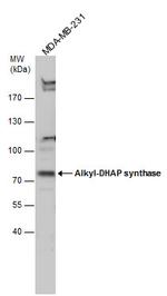 AGPS Antibody in Western Blot (WB)