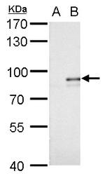 AGPS Polyclonal Antibody