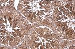 PGK1 Polyclonal Antibody