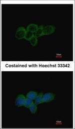 LDHA Antibody in Immunocytochemistry (ICC/IF)