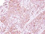 LDHA Antibody in Immunohistochemistry (Paraffin) (IHC (P))