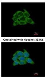 HSP90 beta Polyclonal Antibody