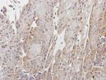 CPNE1 Polyclonal Antibody
