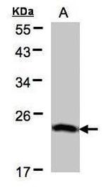 BTF3 Polyclonal Antibody