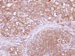 RhoGAP Polyclonal Antibody