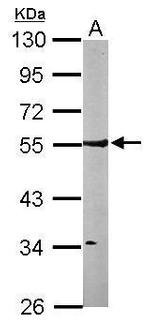 RhoGAP Antibody in Western Blot (WB)