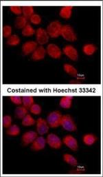Transketolase Polyclonal Antibody