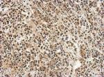 PTBP1 Antibody in Immunohistochemistry (Paraffin) (IHC (P))