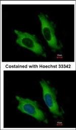 eIF4A2 Polyclonal Antibody