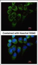 YARS Polyclonal Antibody