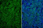 CD19 Antibody in Immunohistochemistry (Paraffin) (IHC (P))
