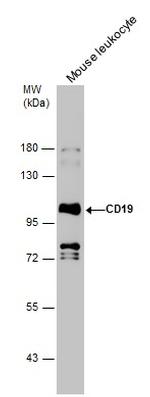 CD19 Antibody in Western Blot (WB)