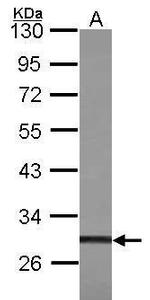 ZFP36L1 Polyclonal Antibody