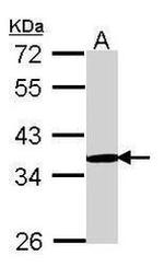 PSMD11 Antibody in Western Blot (WB)
