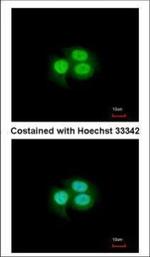 MSI1 Antibody in Immunocytochemistry (ICC/IF)