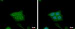 CRABP2 Polyclonal Antibody