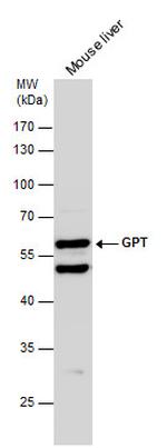 GPT Antibody in Western Blot (WB)