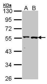 GPT Polyclonal Antibody