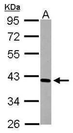 CD123 Antibody in Western Blot (WB)