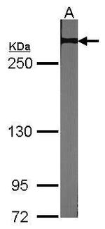 NOTCH2 Antibody in Western Blot (WB)