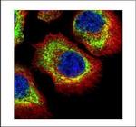 alpha Adducin Polyclonal Antibody