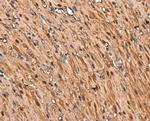 TAGLN Antibody in Immunohistochemistry (Paraffin) (IHC (P))