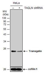 TAGLN Antibody in Western Blot (WB)
